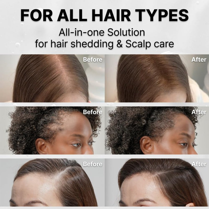 Hair Growth Serum with Built-in Massage Brush 100ml Axl