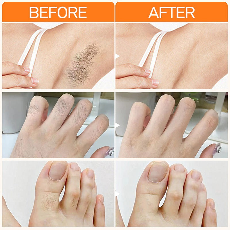 Men & Women Gentle Lip Hair Remover Cream Axl