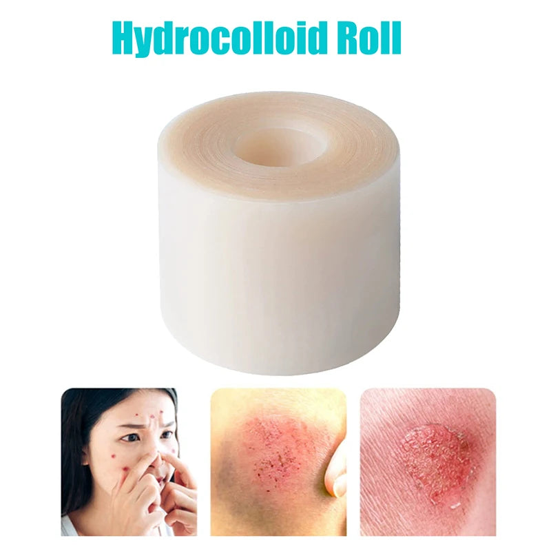 Hydrocolloid Roll Bandage – Waterproof Self-Adhesive Wound Care Hydrocolloid Bandage Axl