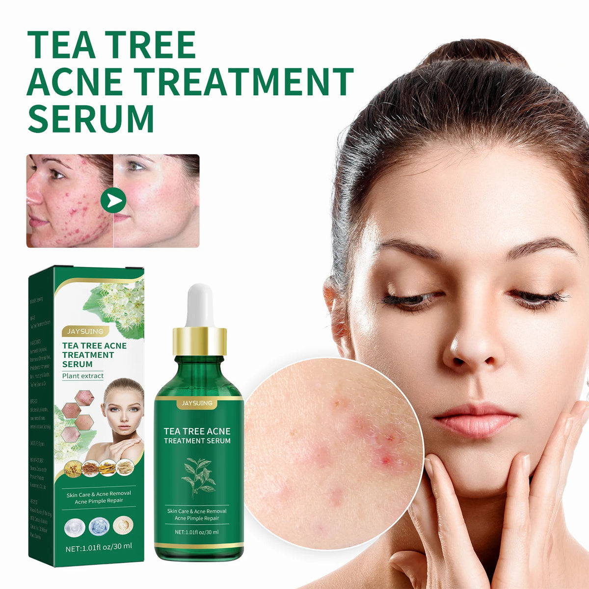 Tea Tree Oil Face Serum – Blemish & Redness Control 30ml Face Serum Axl