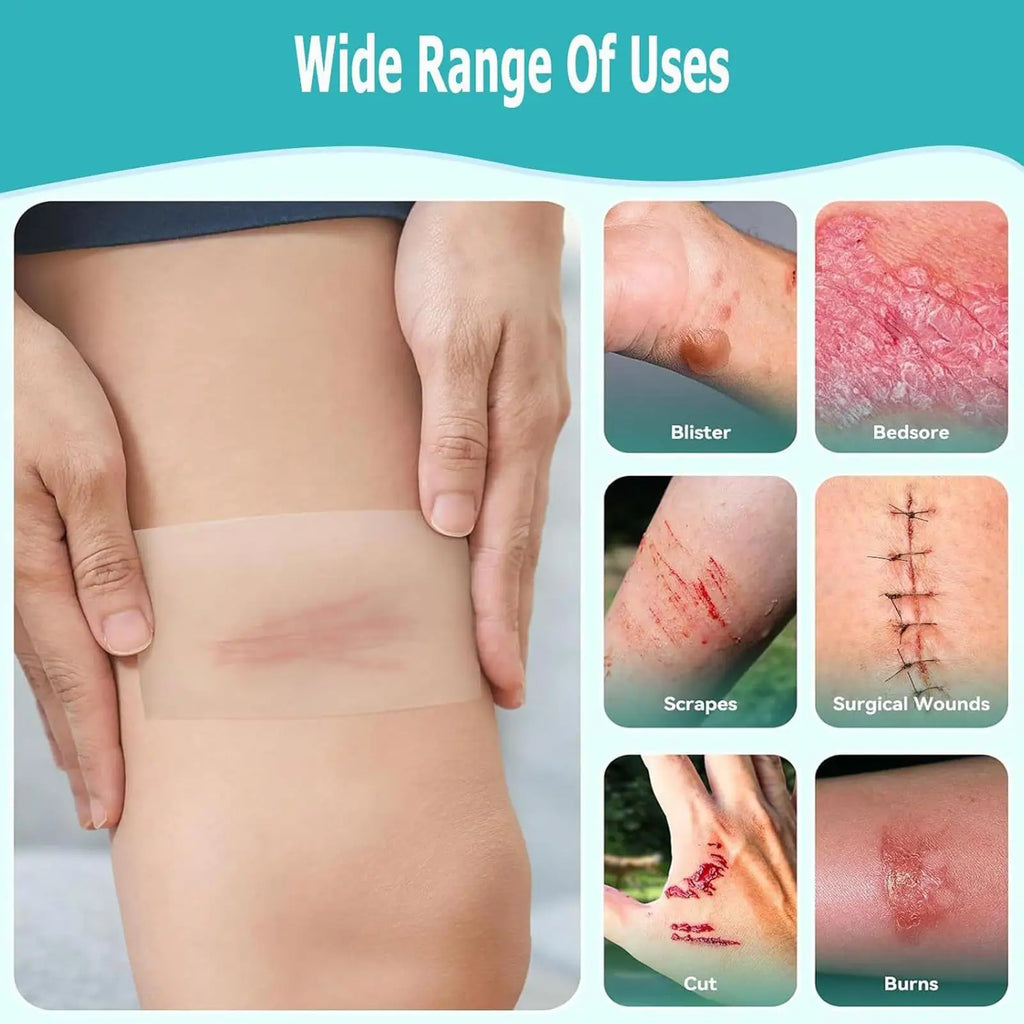 Hydrocolloid Roll – Waterproof Pimple & Blister Patch Tape Hydrocolloid Patch Roll Axl