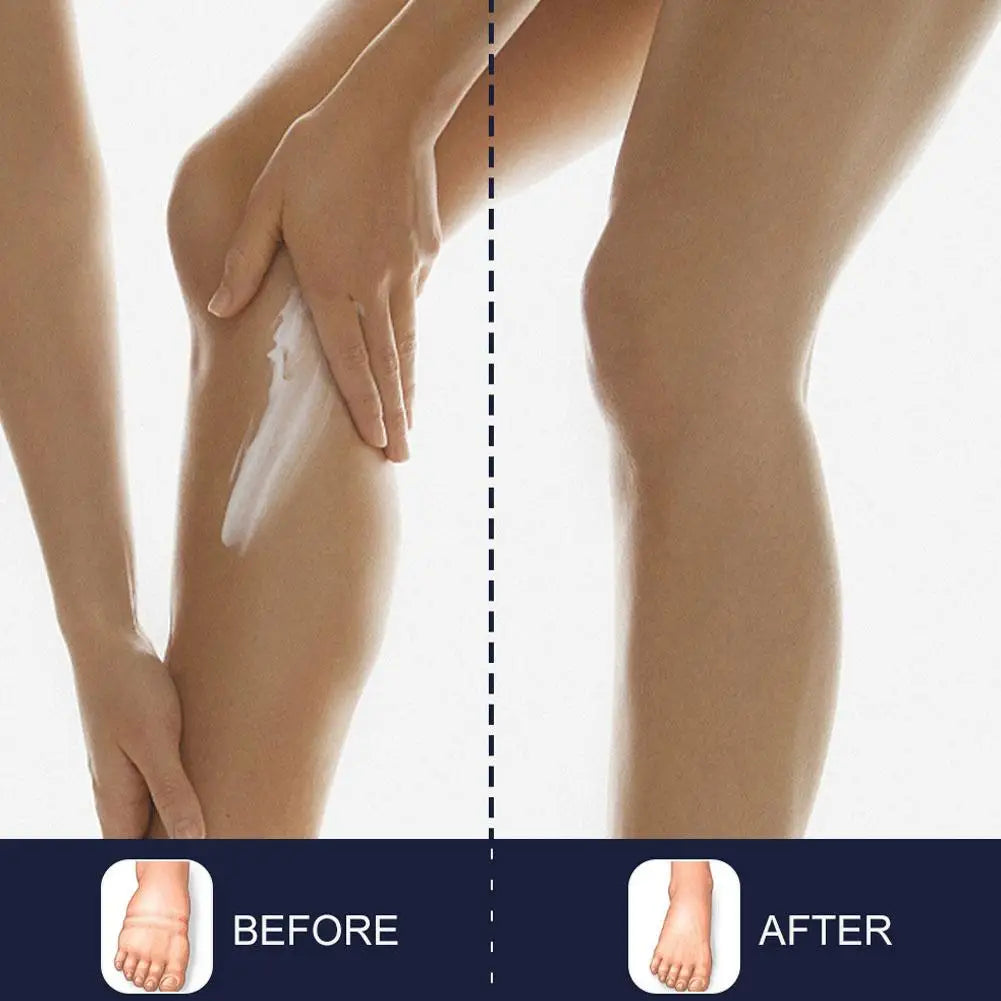 Eelhoe Leg & Foot Massage Cream – Swelling Comfort 20g Foot Massage Cream Axl