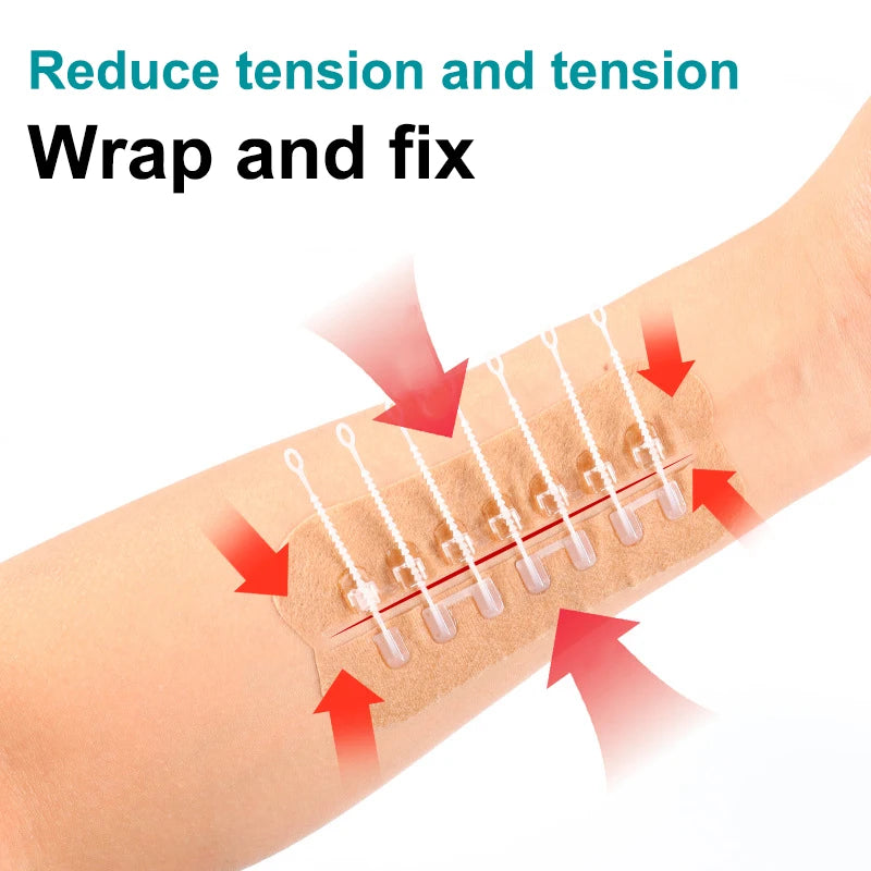 Zipper Wound Closure Patch – Sutureless Hemostatic Bandage Wound Closure Bandage Axl