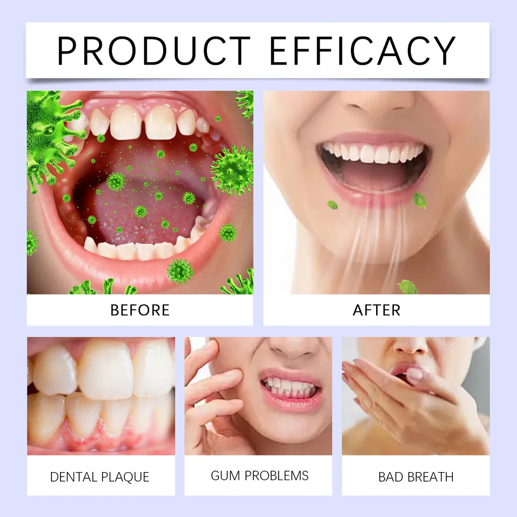 Teeth Brightening Peppermint Mouthwash – Mouth Rinse 237ml Whitening Mouthwash Axl