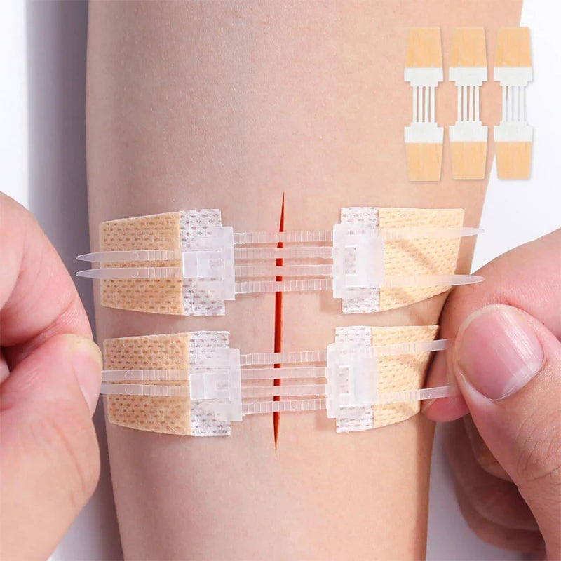 Zipper Wound Closure Patch – Waterproof Sutureless Bandage Wound Closure Patch Axl