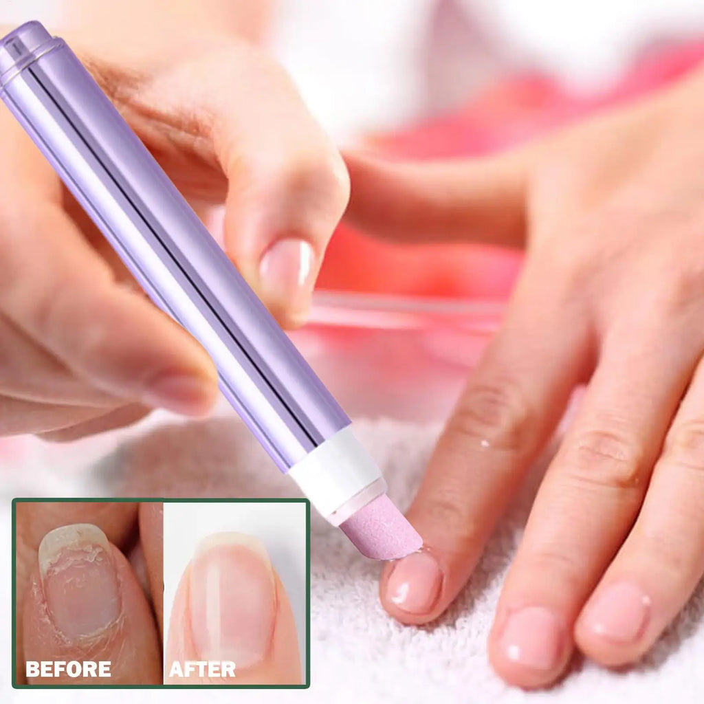 Nail Strengthener & Cuticle Oil Pen – Manicure Care Tool Nail Care Pen Axl