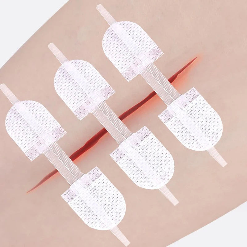 Zipper Wound Closure Patches – Elastic Breathable Zip Bandages Wound Closure Patch Axl