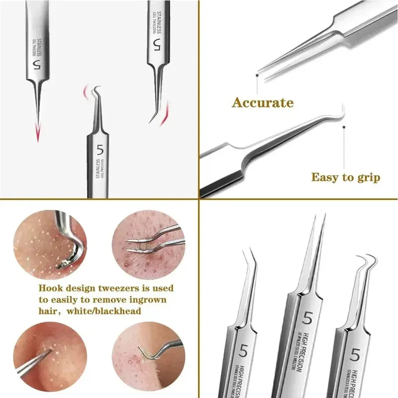 Ultra-Fine Blackhead Remover Tweezer & Acne Clip Tool Blackhead Remover Tool Axl