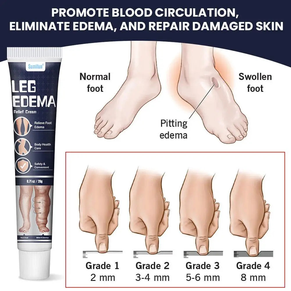 Eelhoe Leg & Foot Massage Cream – Swelling Comfort 20g Foot Massage Cream Axl