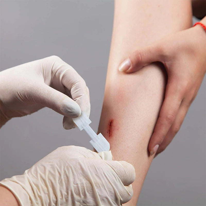 Zipper Wound Closure Patch – Waterproof Sutureless Bandage Wound Closure Patch Axl