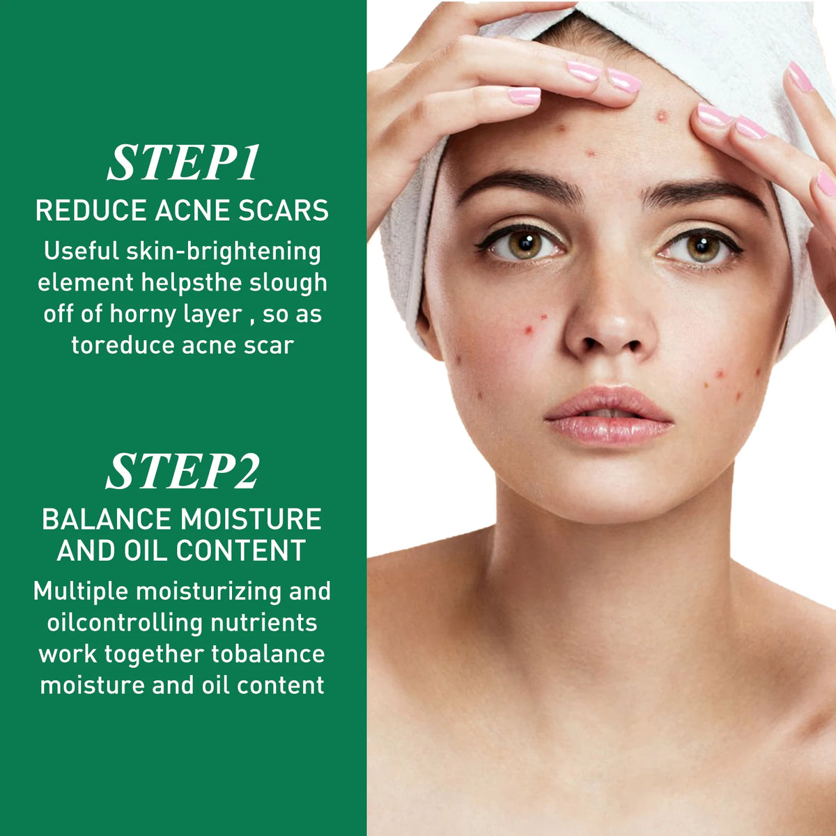 Tea Tree Oil Face Serum – Blemish & Redness Control 30ml Face Serum Axl