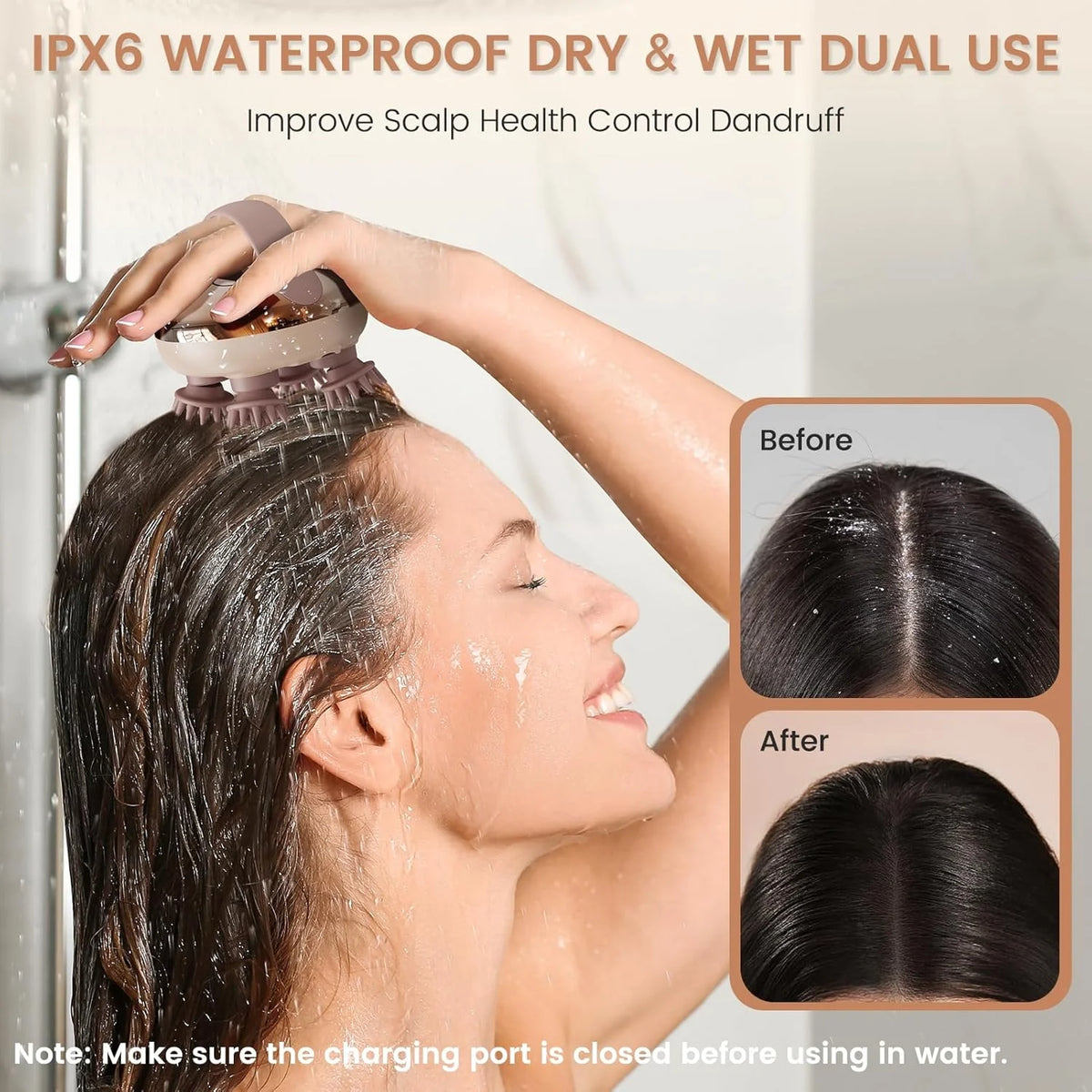 Electric Scalp Massager IPX6 Waterproof – Rechargeable Head Scrubber Electric Scalp Massager Axl