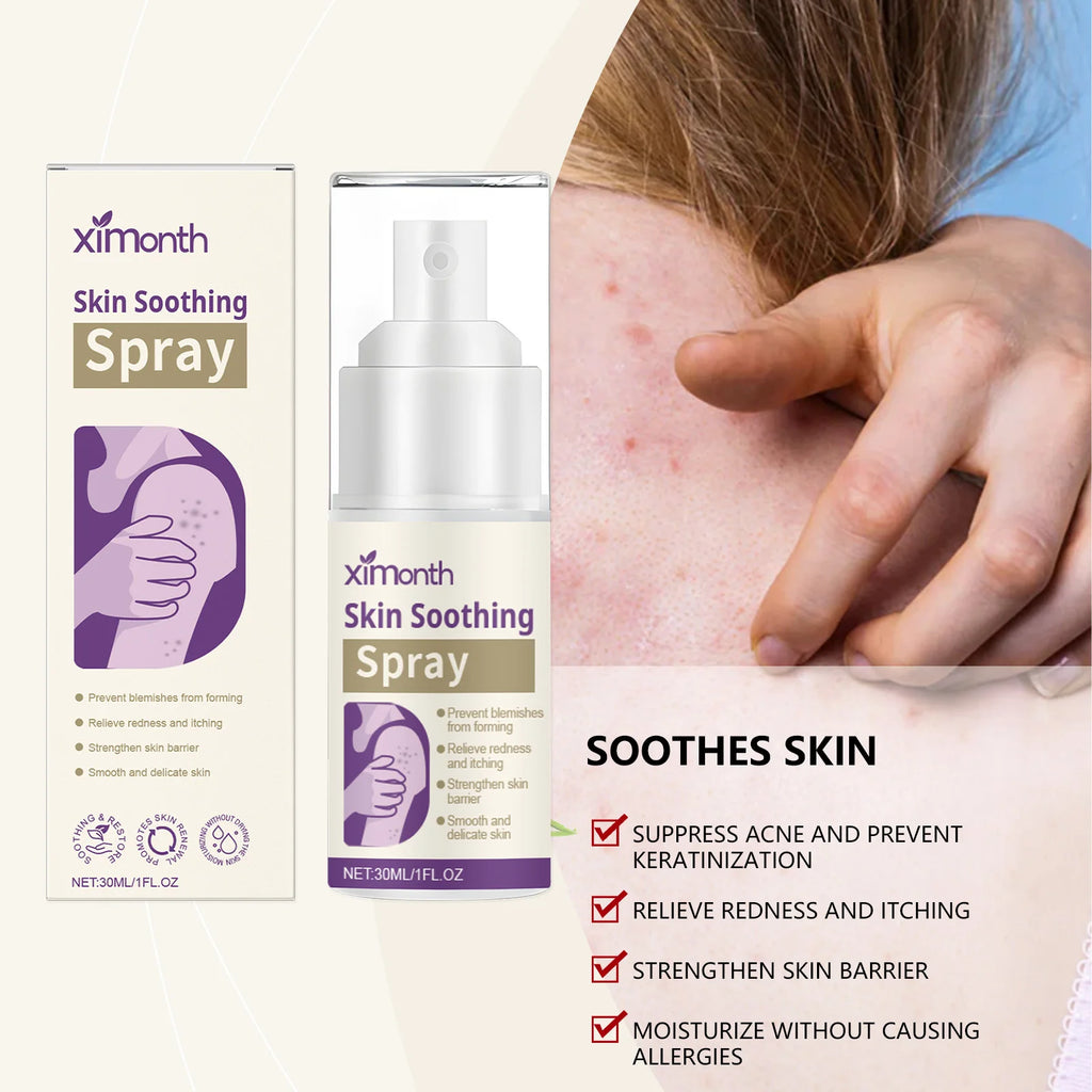 Ximonth Botanical Hydrating Face Mist – Calming Skin Spray Hydrating Face Mist Axl