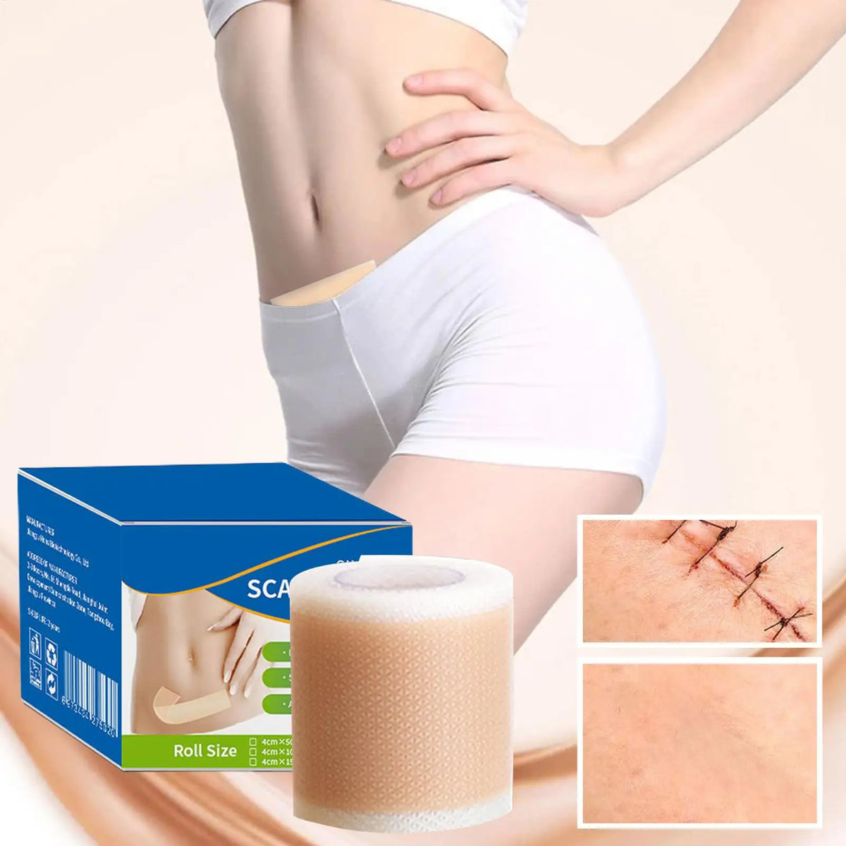 Silicone Scar Sheets – Reusable Self-Adhesive Breathable Tape Silicone Scar Tape Axl