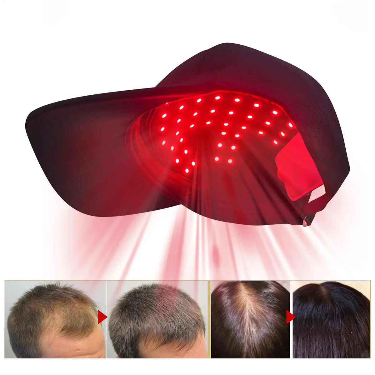 LED Red Light Hair Growth Cap – Wireless Rechargeable Unisex LED Hair Growth Cap Axl