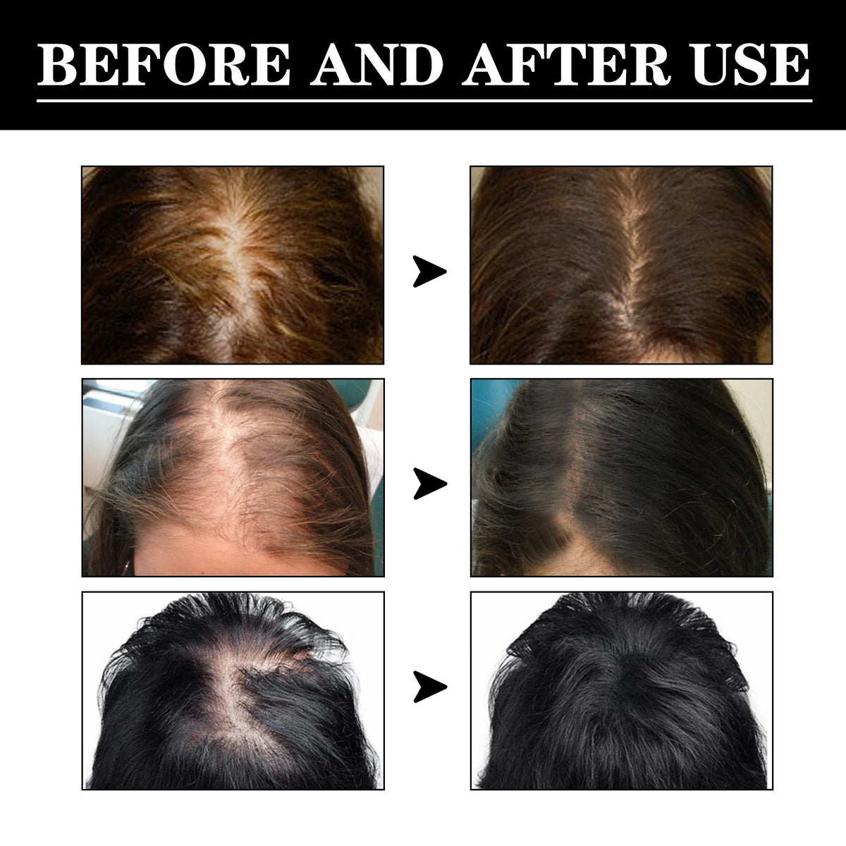 Jaysuing Scalp Nourishing Hair Serum – Panthenol & Glycerin Hair Scalp Serum Axl