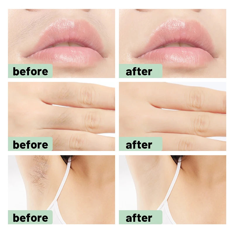 Facial Wax Strips for Lip, Chin & Eyebrow – 12/24 Pcs Facial Wax Strips Axl