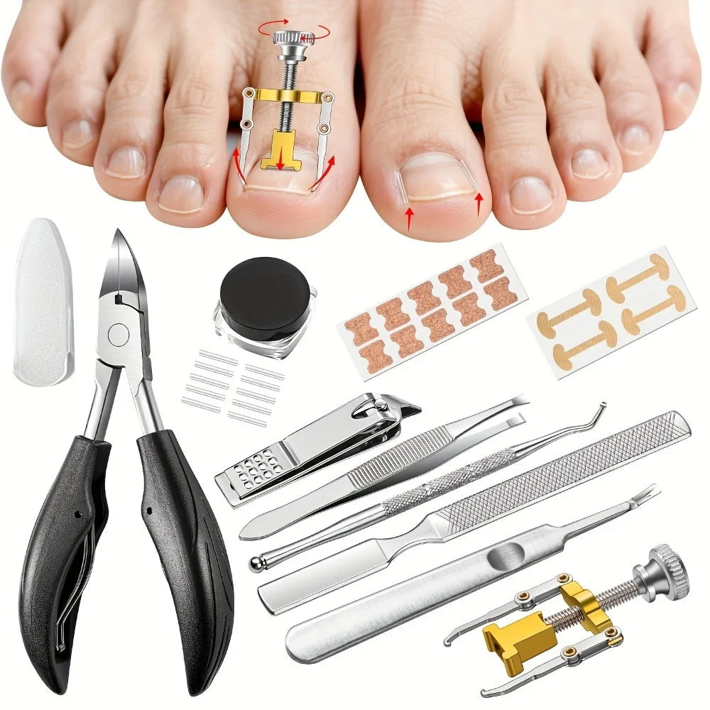 129-Piece Nail Embedding Tool Set – Pliers, Lifter & Cuticle Kit Nail Embedding Tool Set Axl