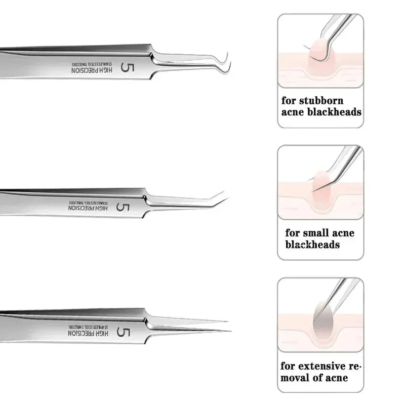 Ultra-Fine Blackhead Remover Tweezer & Acne Clip Tool Blackhead Remover Tool Axl