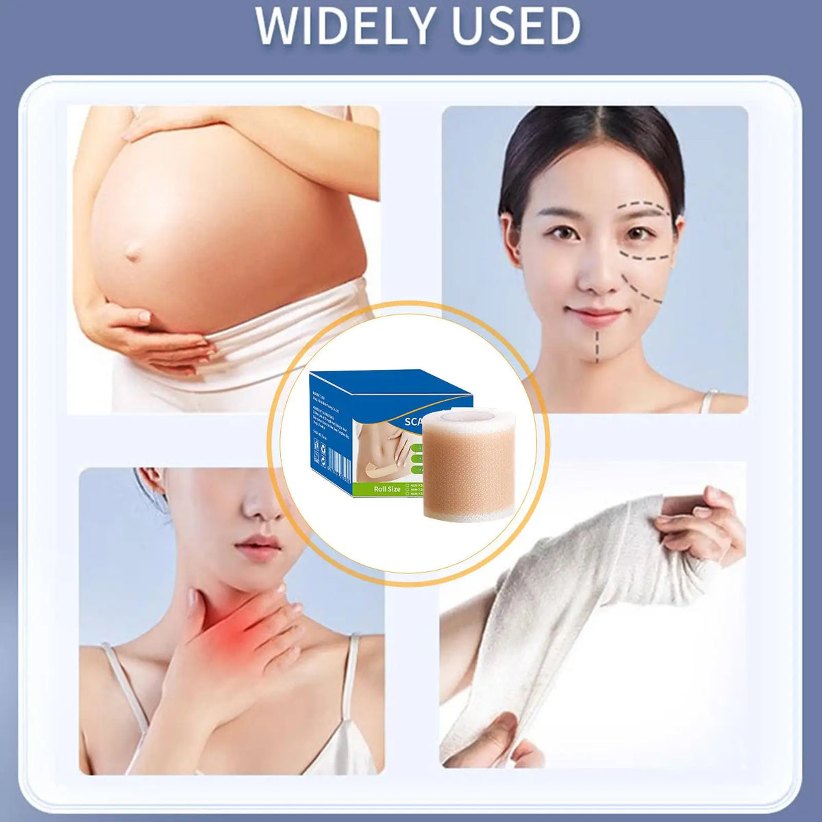 Silicone Scar Sheets – Reusable Self-Adhesive Breathable Tape Silicone Scar Tape Axl
