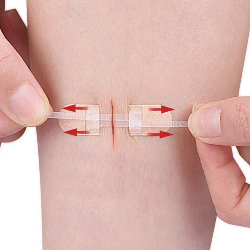 Zipper Wound Closure Patches – Elastic Breathable Zip Bandages Wound Closure Patch Axl