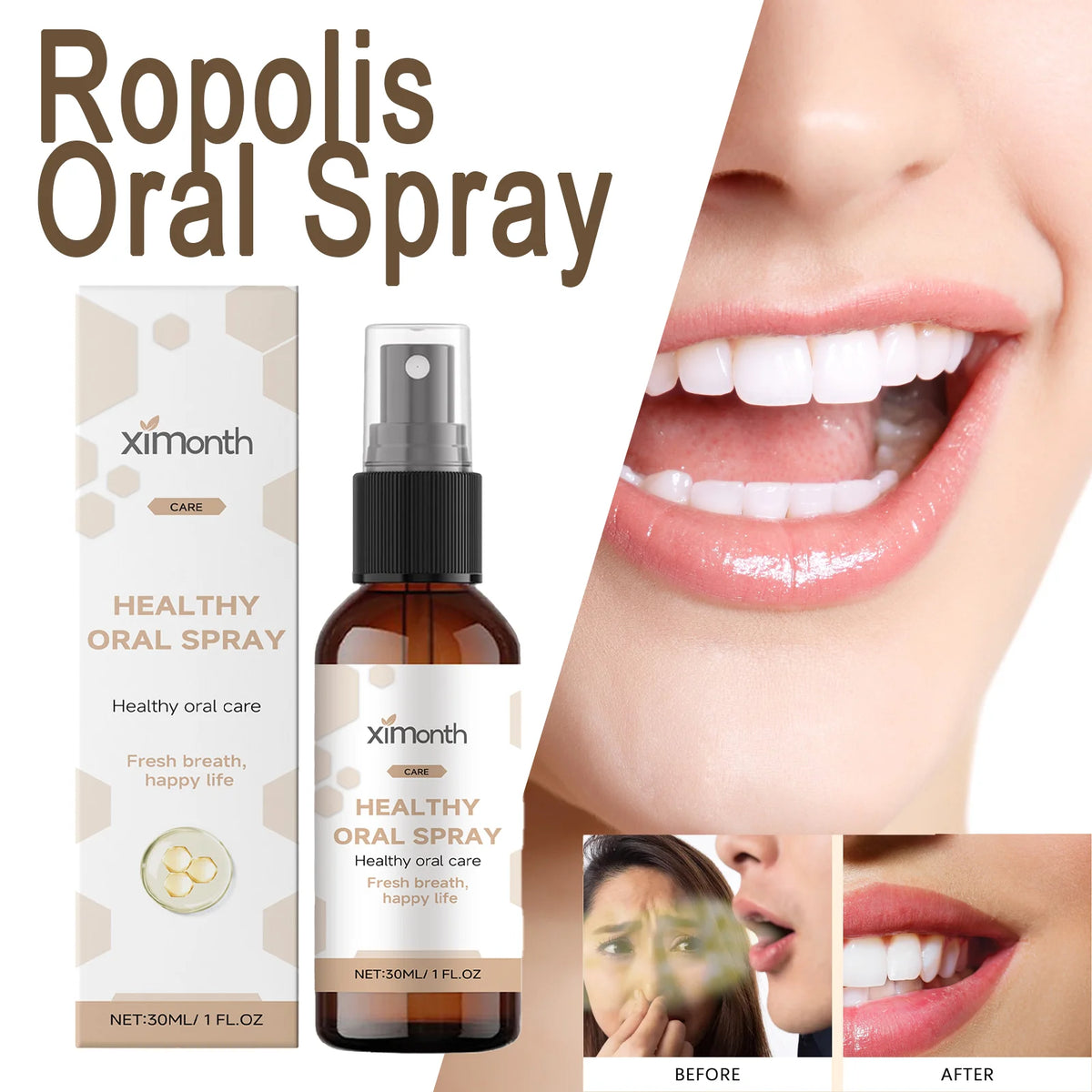 Ximonth Propolis Mint Oral Spray – Fresh Breath 30ml Oral Breath Spray Axl 1 Pcs