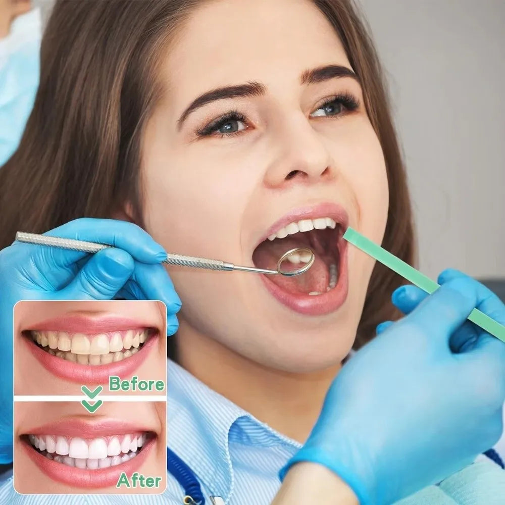 Dental Polishing Strips – Color-Coded Tooth Finishing Roll Dental Polishing Strips Axl