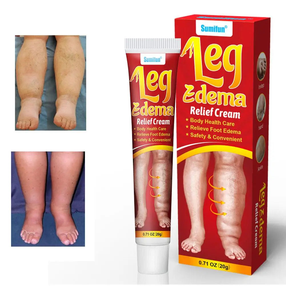 Eelhoe Leg & Foot Massage Cream – 20g Natural Comfort Ointment Leg Massage Cream Axl