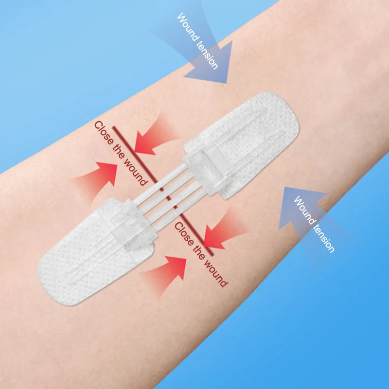Zipper Wound Closure Patch – Waterproof Sutureless Bandage Wound Closure Patch Axl