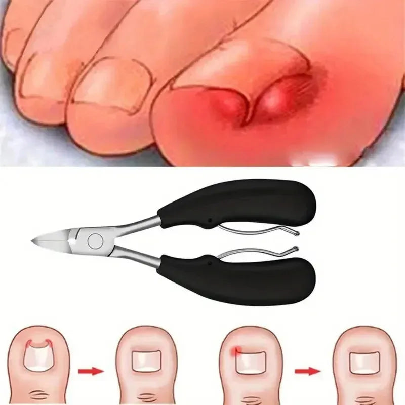 Heavy-Duty Nail Clipper Set – Thick & Ingrown Toenail Tools Nail Clipper Set Axl