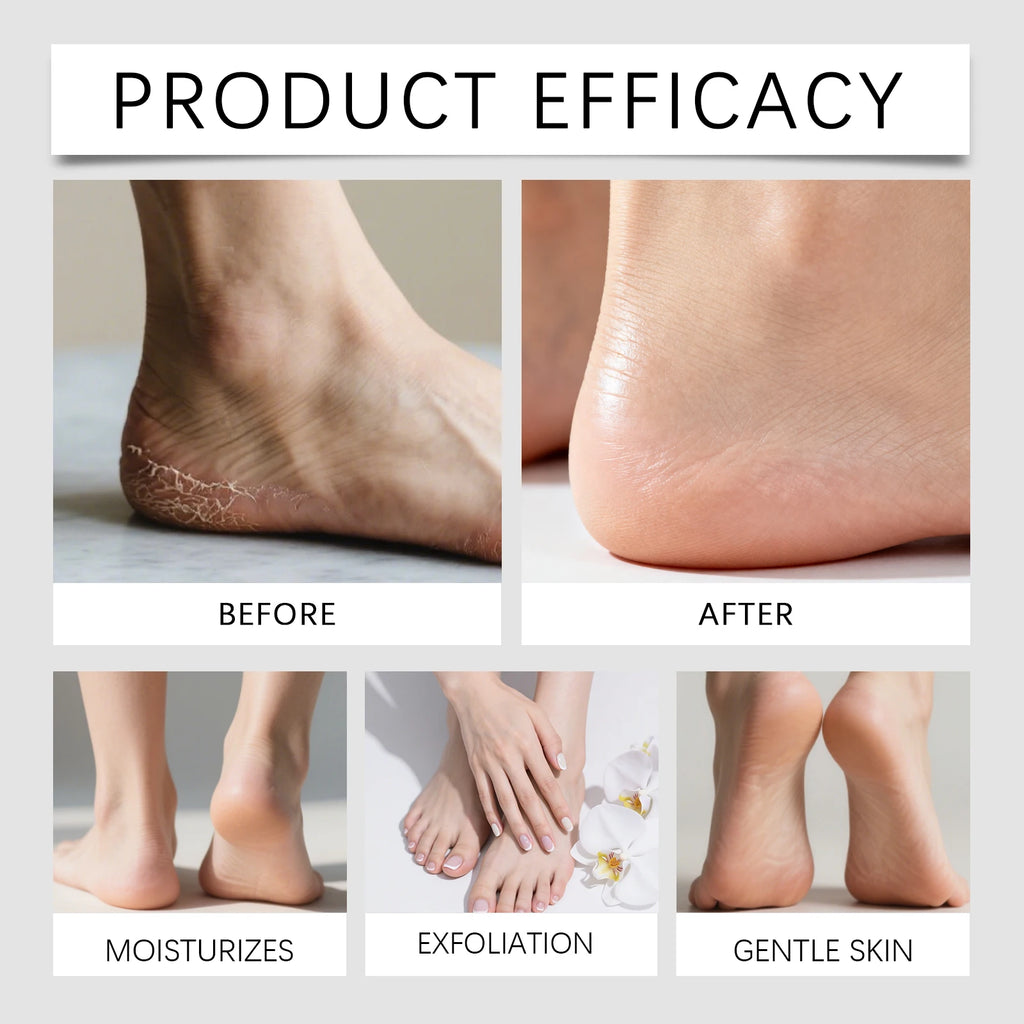 Natural Volcanic Pumice Stone – Foot & Hand Exfoliating File Pumice Stone Axl
