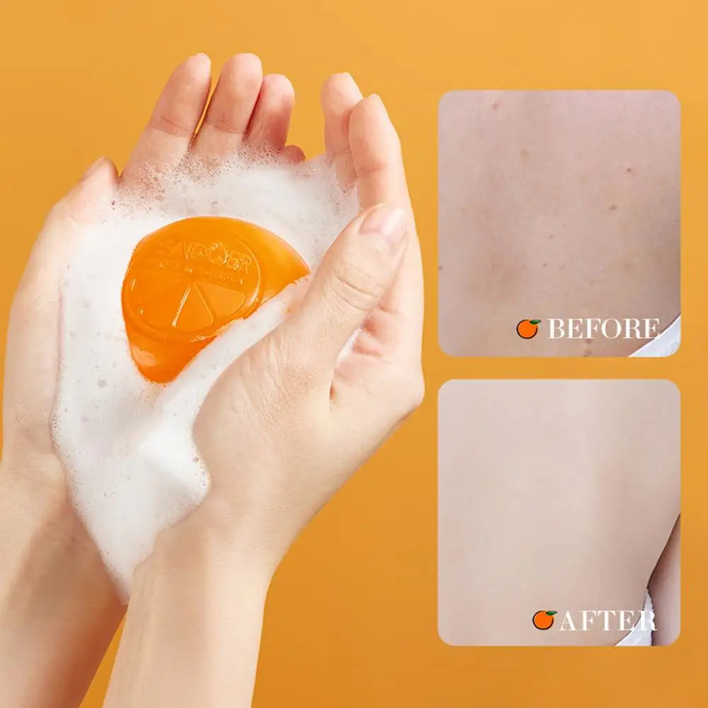Vitamin C Moisturizing Body Soap – Hydrating Handmade Bar Body Soap Bar Axl