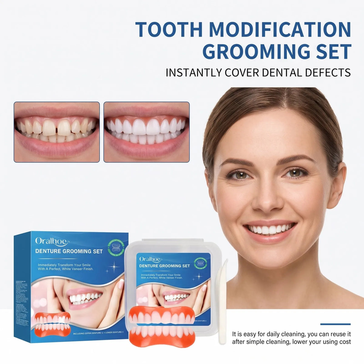 Snap-On Veneer Denture Set – Covers Tooth Gaps, Natural Look Snap-On Dental Veneers Axl