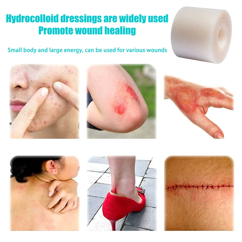 Hydrocolloid Roll Bandage – Waterproof Self-Adhesive Wound Care Hydrocolloid Bandage Axl
