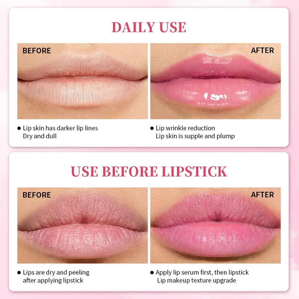 Pink Lip Brightening Serum – Hydrating & Lightening Balm Lip Brightening Serum Axl