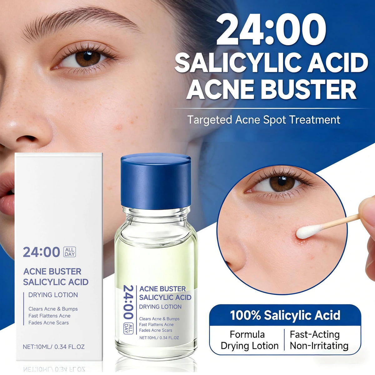 Salicylic Acid Drying Lotion – Spot Treatment & Pore Minimizer Acne Spot Treatment Axl