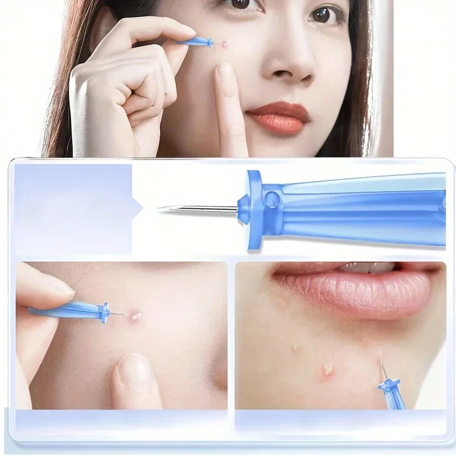 Blackhead & Pore Cleaning Kit – Superfine Extractor Needles Pore Cleaning Kit Axl
