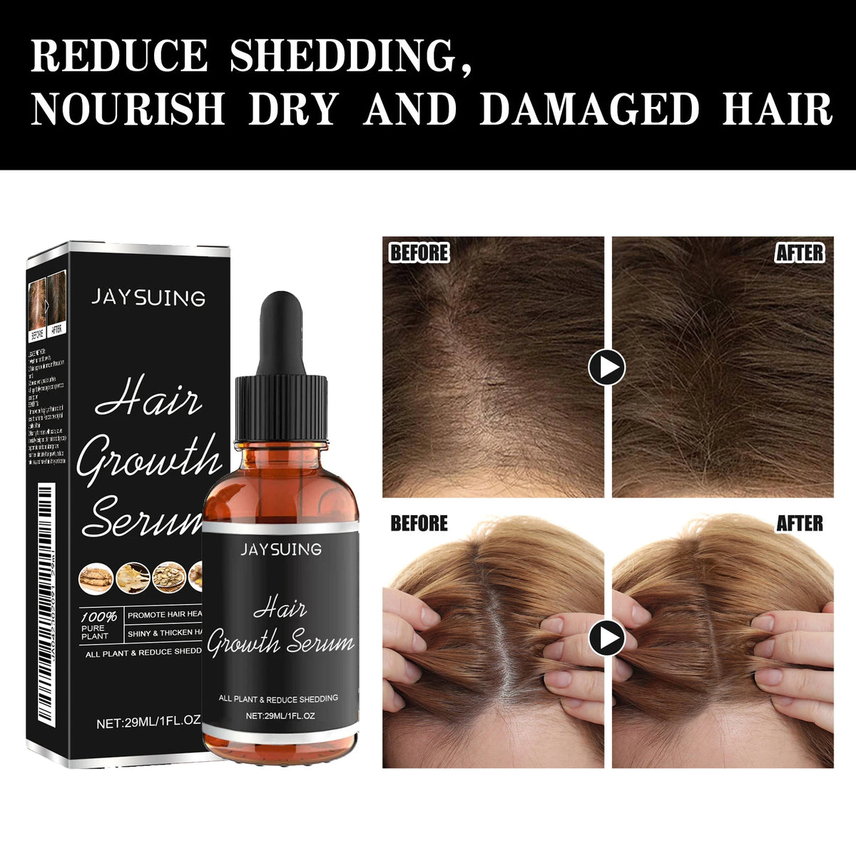 Jaysuing Scalp Nourishing Hair Serum – Panthenol & Glycerin Hair Scalp Serum Axl