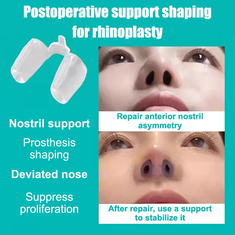 Silicone Nostril Support Clip – Nose Shaping & Breathing Aid Nostril Support Clip Axl