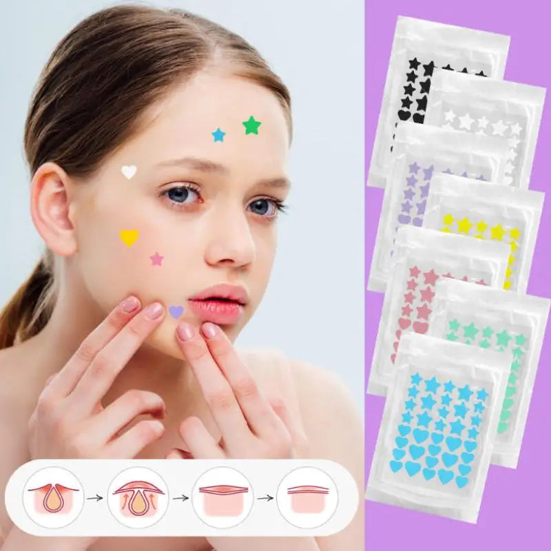 36-Pc Star Hydrocolloid Blemish Patches – Invisible Acne Cover Blemish Patches Axl