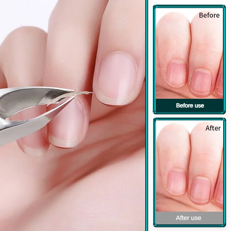 Stainless Steel Cuticle Nipper D501 – Professional Nail Tool Cuticle Nipper Axl