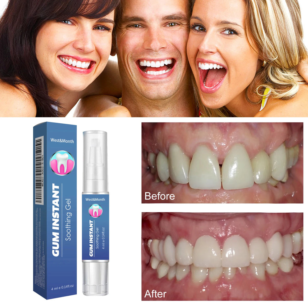 Gum Repair Strengthening Gel – Aloe Vera Deep Clean 4ml Oral Care Gel Axl