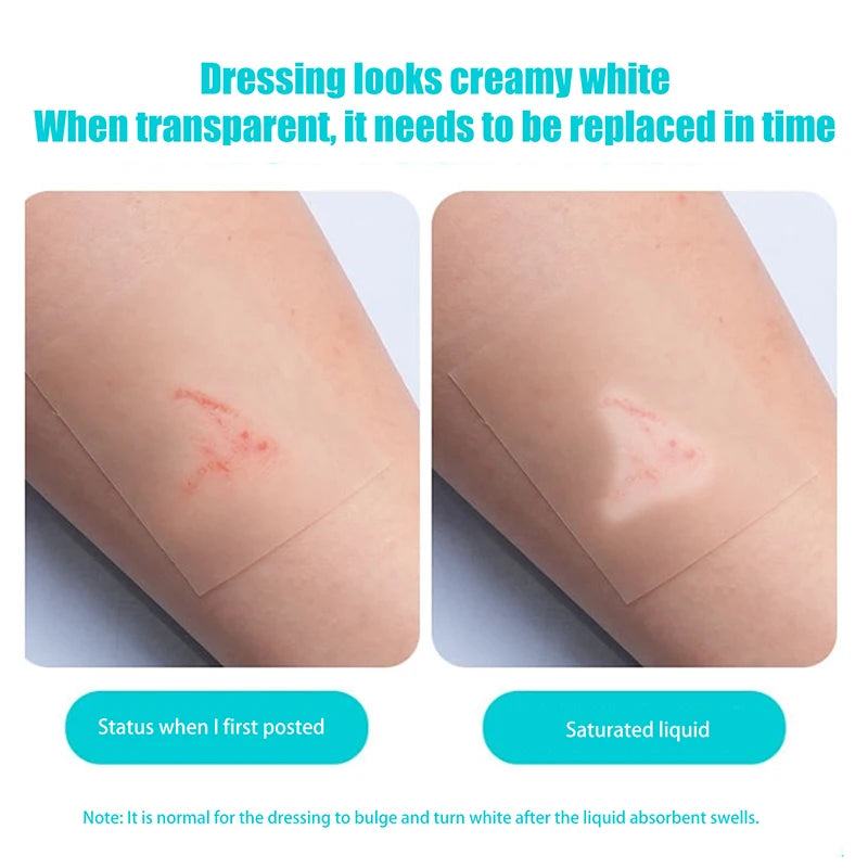 Hydrocolloid Roll Bandage – Waterproof Self-Adhesive Wound Care Hydrocolloid Bandage Axl