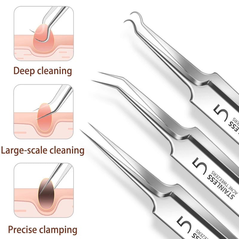 Blackhead Removal Tweezers Set – 2/3 Pcs Stainless Steel Skin Tool Skin Care Tool Set Axl